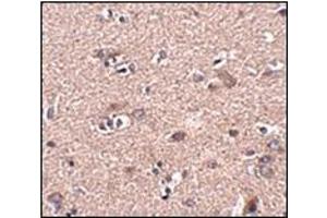 Immunohistochemistry of SCAMP4 in human brain tissue with this product at 2. (SCAMP4 antibody  (C-Term))