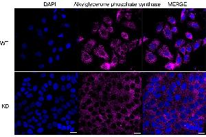 anti-Alkylglycerone Phosphate Synthase (AGPS) antibody