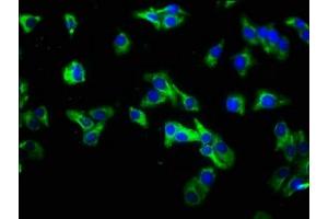 Immunofluorescence staining of HepG2 cells with ABIN7156855 at 1:333, counter-stained with DAPI. (IL22 Receptor alpha 1 antibody  (AA 250-573))