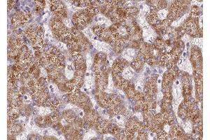 ABIN6277347 at 1/100 staining human liver tissue sections by IHC-P. (CPT2 antibody  (Internal Region))