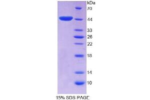 SDS-PAGE (SDS) image for E1A Binding Protein P300 (EP300) (AA 1-158) protein (His tag,GST tag) (ABIN4989075)