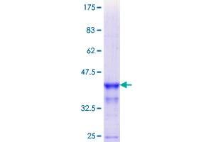 Image no. 1 for T Cell Receptor alpha Locus (TRA) (AA 133-232) protein (GST tag) (ABIN1323483) (TCR alpha Protein (AA 133-232) (GST tag))