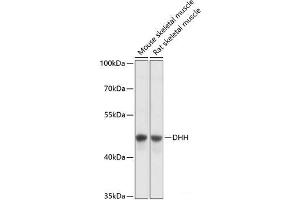 Western blot analysis of extracts of various cell lines using DHH Polyclonal Antibody at dilution of 1:3000. (desert Hedgehog antibody)