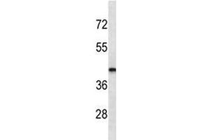 LHX2 antibody western blot analysis in MDA-MB435 lysate.