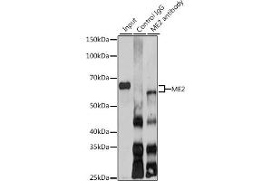 Immunoprecipitation analysis of 200 μg extracts of SKOV3 cells using 3 μg ME2 antibody (ABIN6133037, ABIN6143674, ABIN6143675 and ABIN6225057). (NAD-ME antibody  (AA 220-479))