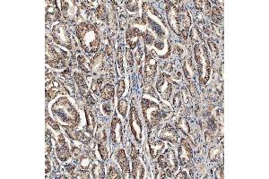 IHC analysis of SCO1 using anti-SCO1 antibody (ABIN7600609). (SCO1 antibody  (AA 21-301))