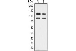 Western blot analysis of CDK11B expression in HepG2 (A), Hela (B) whole cell lysates. (CDK11 antibody  (N-Term))