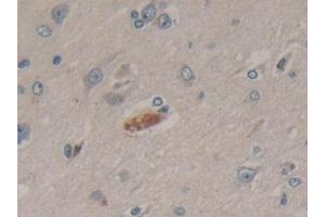 Immunohistochemistry (IHC) image for anti-Peptidylprolyl Isomerase D (PPID) (AA 7-206) antibody (ABIN7440194)