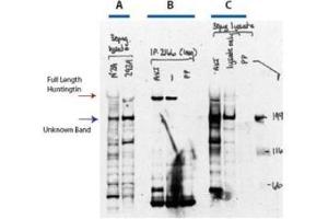 Western blot analysis after AKT and phosphatase treatment is shown using  Affinity Purified anti-Huntingtin pS421 antibody. (Huntingtin antibody  (pSer421))