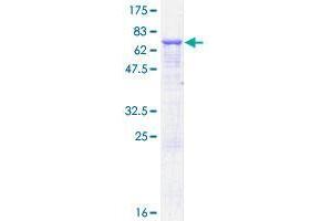 AP3M2 Protein (AA 1-418) (GST tag)