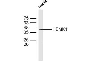Mouse testis lysates probed with HEMK1 Polyclonal Antibody, Unconjugated  at 1:300 dilution and 4˚C overnight incubation. (HEMK1 antibody  (AA 21-120))