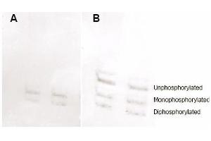 MYL12A anticorps  (pSer19, pSer20)
