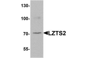 Western blot analysis of LZTS2 in human kidney tissue lysate with LZTS2 Antibody  at 1 μg/ml.