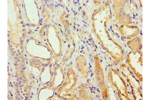 Immunohistochemistry of paraffin-embedded human kidney tissue using ABIN7142020 at dilution of 1:100 (AGPAT1 antibody  (AA 204-283))