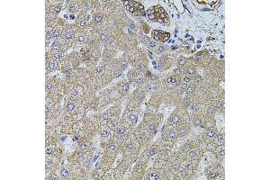 Immunohistochemistry of paraffin-embedded human liver injury using FLNB antibody (ABIN5971317) at dilution of 1/100 (40x lens).