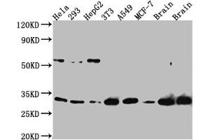 Western Blot Positive WB detected in: Hela whole cell lysate, 293 whole cell lysate, HepG2 whole cell lysate, NIH/3T3 whole cell lysate, A549 whole cell lysate, MCF-7 whole cell lysate, Mouse Brain whole cell lysate, Rat Brain whole cell lysate All lanes: PGAM1 Antibody at 1:1000 Secondary Goat polyclonal to rabbit IgG at 1/50000 dilution Predicted band size: 28 kDa Observed band size: 29 kDa (Recombinant PGAM1 antibody)