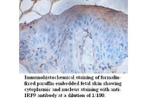 Image no. 1 for anti-Interferon Regulatory Factor 9 (IRF9) antibody (ABIN1577323)