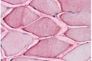 Human Skeletal Muscle: Formalin-Fixed, Paraffin-Embedded (FFPE) (SLC1A5 antibody  (Internal Region))