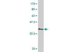 Western Blot detection against Immunogen (39. (EPH Receptor B4 antibody  (AA 198-323))