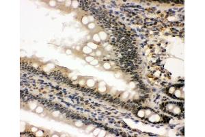 IHC analysis of nmt55/p54nrb using anti-nmt55/p54nrb antibody (ABIN3044530). (NONO antibody  (N-Term))