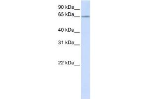 RSPRY1 antibody used at 1 ug/ml to detect target protein. (RSPRY1 antibody  (N-Term))