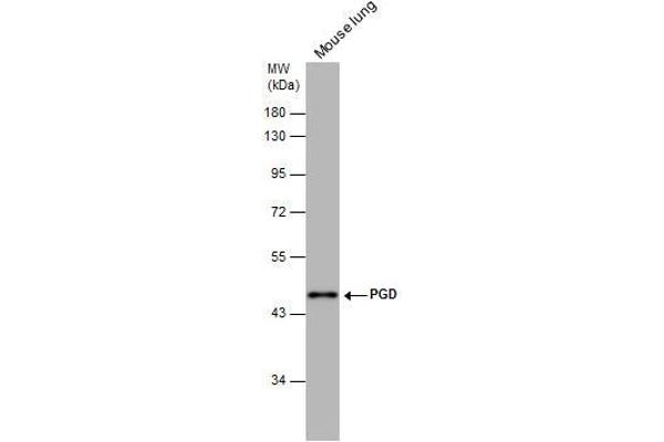 PGD antibody