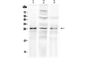 Western blot analysis of FGF8 using anti-FGF8 antibody . (FGF8 antibody  (AA 23-233))