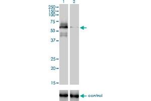 Western blot analysis of RAD18 over-expressed 293 cell line, cotransfected with RAD18 Validated Chimera RNAi (Lane 2) or non-transfected control (Lane 1). (RAD18 antibody  (AA 332-430))