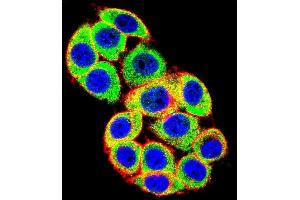 Confocal immunofluorescent analysis of PRKCA Antibody (N-term) (ABIN652517 and ABIN2842346) with Hela cell followed by Alexa Fluor 488-conjugated goat anti-rabbit lgG (green). (PKC alpha antibody  (N-Term))