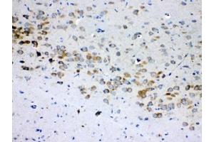 IHC testing of FFPE rat brain tissue with RPS6 antibody at 1ug/ml. (RPS6 antibody  (AA 13-52))