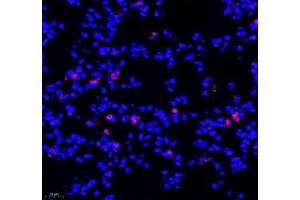 Immunofluorescence of paraffin embedded mouse lung using SIX1 (ABIN7075617) at dilution of 1: 650 (400x lens) (SIX Homeobox 1 antibody)