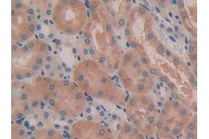 IHC-P analysis of Mouse Kidney Tissue, with DAB staining. (IL5RA antibody  (AA 41-203))