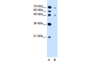 Western Blotting (WB) image for anti-Zinc Finger, FYVE Domain Containing 27 (ZFYVE27) antibody (ABIN2462818) (ZFYVE27 antibody)