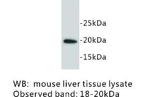 Image no. 1 for anti-Lymphocyte Antigen 6 Complex, Locus A (Ly6a) antibody (ABIN1112928) (Sca-1/Ly-6A/E antibody)