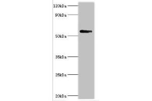 Western blot All lanes: Bromodomain-containing protein 9 antibody at 2 μg/mL + Mouse liver tissue Secondary Goat polyclonal to rabbit IgG at 1/10000 dilution Predicted band size: 68, 23, 54, 27, 56, 61 kDa Observed band size: 68 kDa (BRD9 antibody  (AA 338-597))