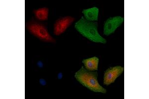 ABIN6262721 and ABIN6278917 staining  cells by IF/ICC. (KRT32 antibody  (Internal Region))