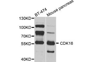 Western blot analysis of extracts of various cell lines, using CDK16 antibody. (CDK16 antibody)