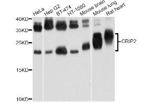 Western blot analysis of extracts of various cell lines, using CRIP2 Antibody.