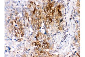 Immunohistochemistry (Paraffin-embedded Sections) (IHC (p)) image for anti-Protein Phosphatase 1, Regulatory (Inhibitor) Subunit 1B (PPP1R1B) (AA 1-36), (N-Term) antibody (ABIN3044534)