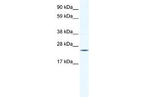 WB Suggested Anti-KCTD6 Antibody Titration:  0. (KCTD6 antibody  (N-Term))