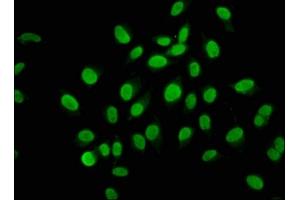 Immunofluorescence staining of A549 cells with ABIN7165027 at 1:133, counter-stained with DAPI. (AHNAK2 antibody  (AA 195-349))