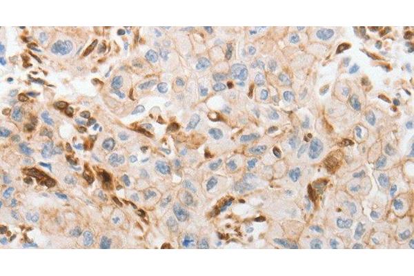 SLC15A2 antibody