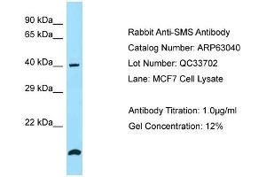 Western Blotting (WB) image for anti-Spermine Synthase, SMS (SMS) (N-Term) antibody (ABIN2789345)