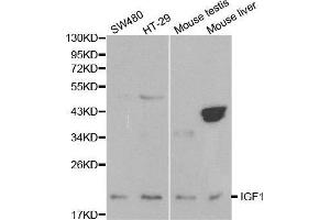 Western blot analysis of extracts of various cell lines, using IGF1 antibody. (IGF1 antibody  (C-Term))