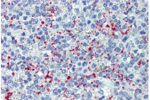 Human Spleen (formalin-fixed, paraffin-embedded) stained with SELP antibody ABIN462342 followed by biotinylated anti-mouse IgG secondary antibody ABIN481714, alkaline phosphatase-streptavidin and chromogen. (P-Selectin antibody)