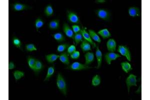 Immunofluorescence staining of A549 cells with ABIN7156159 at 1:100, counter-stained with DAPI. (PLCL1 antibody  (AA 1-108))