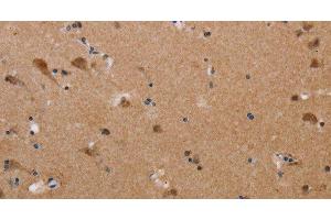 Immunohistochemistry of paraffin-embedded Human brain tissue using PLXNA4 Polyclonal Antibody at dilution 1:50 (Plexin A4 antibody)