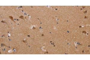 Immunohistochemistry of paraffin-embedded Human brain tissue using PLXNA4 Polyclonal Antibody at dilution 1:50 (Plexin A4 antibody)