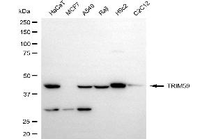 Western blotting analysis using TRIM59 antibody (ABIN7800640).