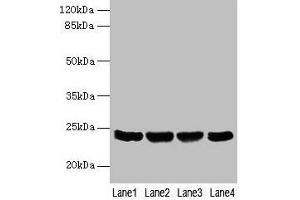 Western blot All lanes: EMC8 antibody at 4 μg/mL Lane 1: A549 whole cell lysate Lane 2: Human placenta tissue Lane 3: Hela whole cell lysate Lane 4: HT29 whole cell lysate Secondary Goat polyclonal to rabbit IgG at 1/10000 dilution Predicted band size: 24, 14 kDa Observed band size: 24 kDa (COX4NB antibody  (AA 1-210))